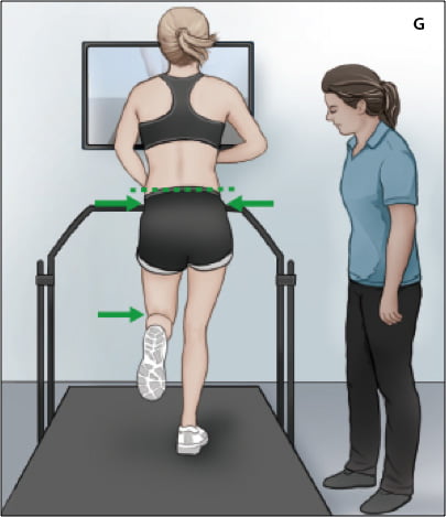 (G) Biofeedback visual no espelho e comando do fisioterapeuta para fornecer os ajustes necessários para o corredor melhorar sua biomecânica.