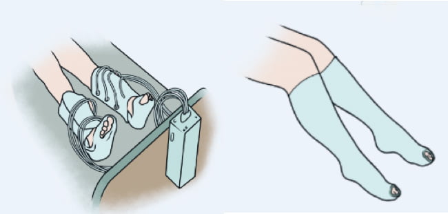 Aparelho compressor pneumático intermitente e meia elástica compressiva